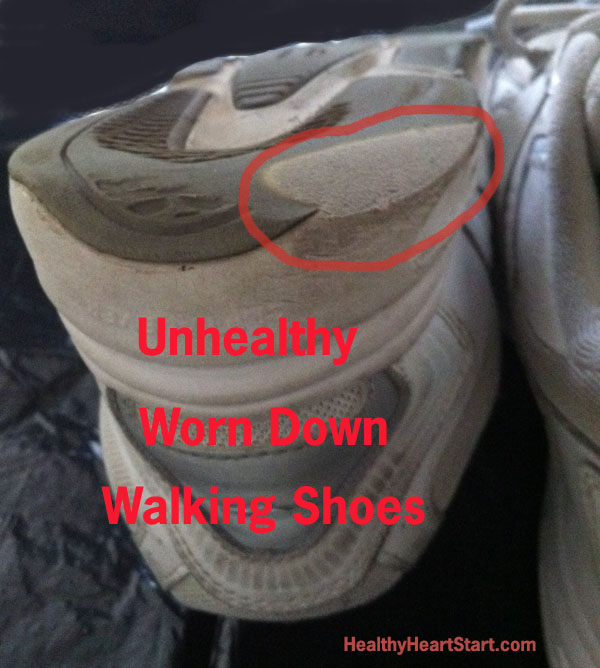 Unhealthy Worn Down Walking Shoes